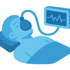 General anesthesia stages and monitoring