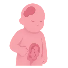 Congenital Anomalies Overview