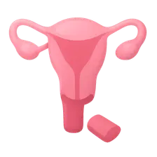 Obstetric Hysterectomy