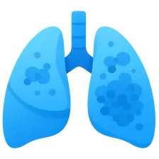 Lower Respiratory Tract Infections