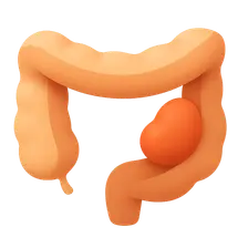 Gastrointestinal stromal tumors