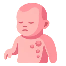 Multiple malformation syndromes