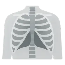 Radiographic Anatomy of Chest