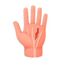 Tendon Injuries