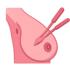 Axillary Surgery