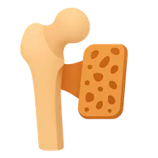 Tissue Engineering in Orthopaedics