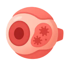 Viral Keratitis