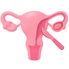 Ectopic pregnancy surgical management