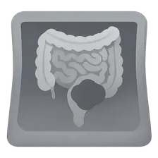 Acute Abdomen Imaging