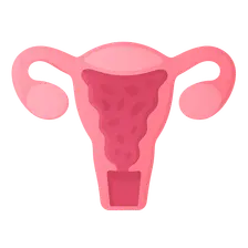 Adenomyosis