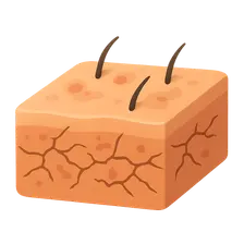 Asteatotic Eczema