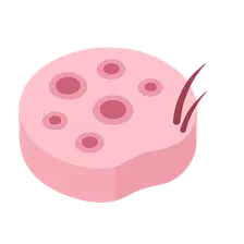 Epstein-Barr Virus Manifestations