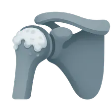 Osteoarthritis of Shoulder