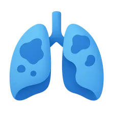 Acute Respiratory Distress Syndrome