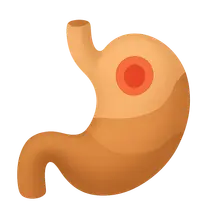 Gastric Disorders