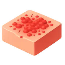 Varicella-Zoster Virus Infections
