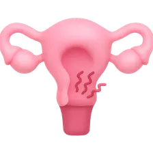 Secondary Dysmenorrhea