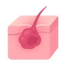 Cosmetic Complications and Management