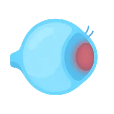 Scleritis: Posterior