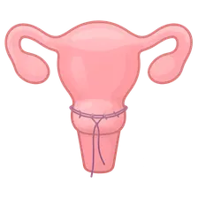 Cervical Cerclage