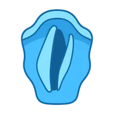 Vocal Cord Paralysis