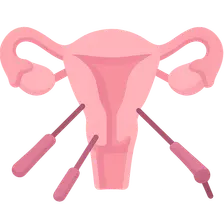 Laparoscopic gynecologic procedures