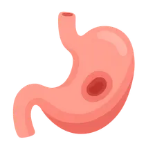 Peptic Ulcer Disease