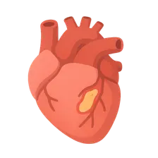 Anesthesia for Coronary Artery Disease