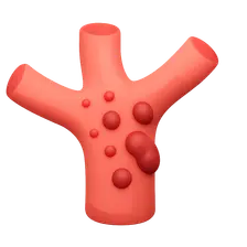 Vasculitis Syndromes