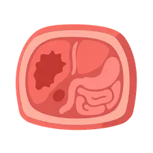 Abdominal Trauma Imaging