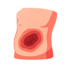 Blunt abdominal trauma