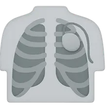 Post-Surgical Chest Imaging
