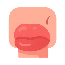 Angioedema
