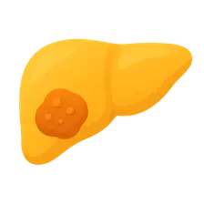 Liver Tumors