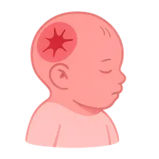 Birth Injuries