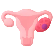 Vulvar Disorders