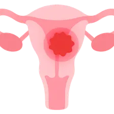 Chronic Pelvic Pain