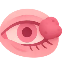 Eyelid Tumors