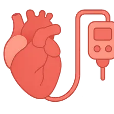 Cardiogenic shock management