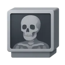 Radiology in Autopsies
