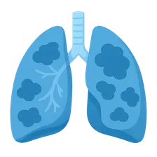 Occupational Lung Diseases