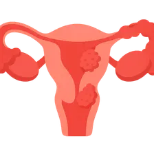 Pelvic Inflammatory Disease