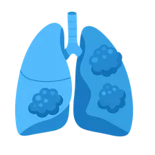 COPD pathophysiology and diagnosis