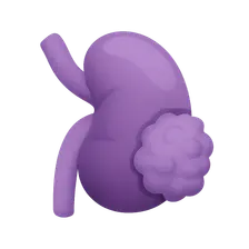 Neuroblastoma