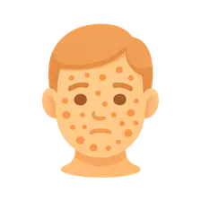 Measles, mumps, rubella