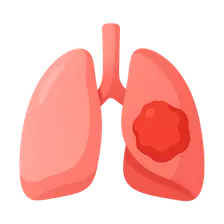Lung Cancer Approach