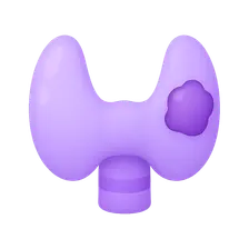 Thyroid Cancer
