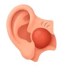 Acute Otitis Media