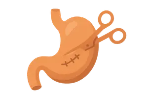 Gastrointestinal Surgery