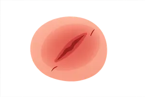 Injuries and Their Significance